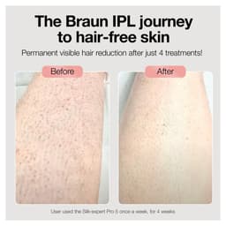 PL1014